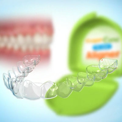 Pflege herausnehmbare Zahnspange / Zahnschiene